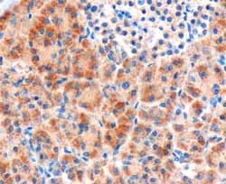 ab40012 at 3µg/ml staining Frizzled 8 in human pancreas tissue by Immunohistochemistry (Formalin/PFA-fixed paraffin-embedded sections). Microwaved antigen retrieval with Tris/EDTA buffer pH9, HRP-staining.