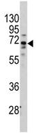 Anti-Frizzled homolog 1 antibody (ab71342) at 1/60 dilution + Hela cell line lysate at 35 µg