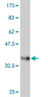 Western blot against tagged recombinant protein immunogen using ab55026 FRZB antibody at 1ug/ml.
