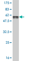 Western blot against tagged recombinant protein immunogen using ab56407 FTS antibody at 1ug/ml.