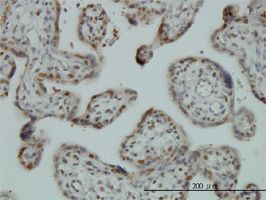FUBP1 antibody (ab56418) used in immunohistochemistry at 3ug/ml on formalin fixed and paraffin embedded human placenta.