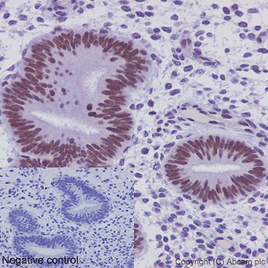 Immunohistochemical analysis of paraffin embedded Human endometrium tissue labeling FUBP1 using ab192867 at a 1/2000 dilution. A prediluted HRP Polymer for Rabbit IgG was used as the secondary antibody. Hematoxylin counterstain.