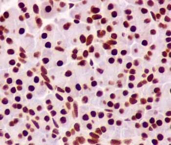 Immunohistochemical analysis of paraffin-embedded Human pancreas tissue labeling FUBP1 with ab181111 at 1/500 dilution followed by prediluted HRP Polymer for Rabbit IgG. Counterstained with Hematoxylin.