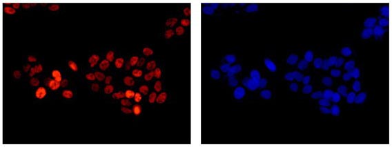 Immunofluorescent analysis of 4% paraformaldehyde-fixed HepG2 cells labeling FUBP1 with ab181111 at 1/500 dilution (red) followed by Goat anti rabbit IgG (Alexa Fluor® 555) secondary antibody at 1/200 dilution. Counter stained with Dapi (blue).