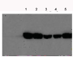 All lanes : Anti-Fumarylacetoacetate hydrolase antibody (ab81087) at 1/500 dilutionLane 1 : Whole cell lysate derived from liver extract from FAH wild type mice Lane 2 : Whole cell lysate derived from liver extract from FAH wild type mice Lane 3 : Whole cell lysate derived from FAH-liver extract from z alleles transgenic miceLane 4 : Whole cell lysate derived from FAH-liver extract from z alleles transgenic mice Lane 5 : Whole cell lysate derived from liver extract from siLucFAH mice