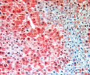 ab81087 at 2µg/ml staining Fumarylacetoacetate hydrolase by Immunohistochemistry (Formalin/PFA-fixed paraffin-embedded mouse liver sections), followed by HRP linked secondary antibody, and visualized by AEC substrate, and counterstaining by hematoxylin.