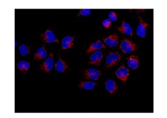 Immunocytochemical analysis of HeLa cells fixed in 20 °C acetone labeling Furin with ab183495 at 1/250 dilution and Goat anti rabbit IgG(Alexa Fluor® 555) at 1/200 dilution. Counterstained with DAPI.