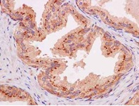Immunohistochemical analysis of paraffin-embedded Human prostate labeling Furin with ab183495 at 1/50 dilution and counterstained with hematoxylin.