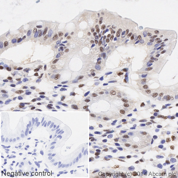 IHC image of CREB staining in a section of formalin-fixed paraffin-embedded normal human colon tissue*, performed on a Leica BOND. The section was pre-treated using heat mediated antigen retrieval with sodium citrate buffer (pH6, epitope retrieval solution 1) for 20mins. The section was then incubated with ab194313 at 1/100 dilution, for 15 mins at room temperature. DAB was used as the chromogen. The section was then counterstained with haematoxylin and mounted with DPX. The inset negative control image is taken from an identical assay without primary antibody.For other IHC staining systems (automated and non-automated) customers should optimize variable parameters such as antigen retrieval conditions, primary antibody concentration and antibody incubation times.*Tissue obtained from the Human Research Tissue Bank, supported by the NIHR Cambridge Biomedical Research Centre.