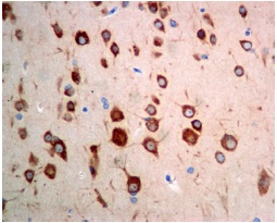 ab129089, at a dilution of 1/100, staining FXR1 in paraffin-embedded Human brain tissue by Immunohistochemistry.
