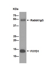 Western blot analysis of immunoprecipitation pellet from Human fetal livert lysate immunoprecipitated using ab191397 at 1/90 dilution.Secondary: Goat Anti-Rabbit IgG, (H+L), Peroxidase conjugate at 1/1000 dilution.