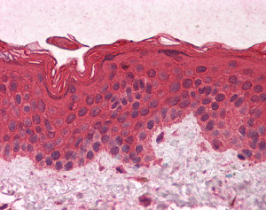 ab118434 at 5µg/ml staining G protein alpha inhibitor 1 in Formalin-fixed, Paraffin-embedded Human skin tissue by Immunohistochemistry.
