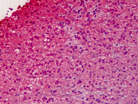ab118434 at 5µg/ml staining G protein alpha inhibitor 1 in Formalin-fixed, Paraffin-embedded Human adrenal tissue by Immunohistochemistry.