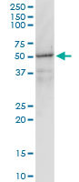 Anti-G protein alpha inhibitor 1 antibody [2B8-2A5] (ab118434) + Human liver tissue lysate