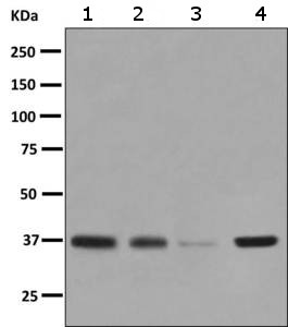 All lanes : Anti-G protein alpha inhibitor 1 antibody [EPR9441(B)] (ab140125) at 1/1000 dilutionLane 1 : SH-SY5Y lysateLane 2 : U-87 MG lysateLane 3 : Human glioma lysateLane 4 : Human fetal brain lysate Lysates/proteins at 10 µg per lane.Secondarygoat anti-rabbit HRP at 1/2000 dilution