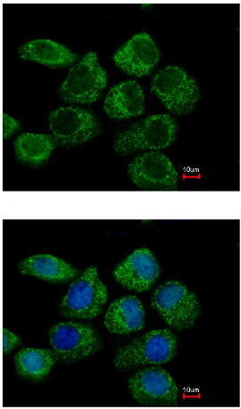 Immunofluorescent analysis of paraformaldehyde-fixed A431 cells labeling G protein alpha Inhibitor 2 with ab154155 at 1/500 dilution. The image in the lower panel was co-stained with Hoechst 33342.