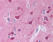 Human Brain, Cortex (formalin-fixed, paraffin-embedded) stained with ab118578 at 10 ug/ml followed by biotinylated goat anti-rabbit IgG secondary antibody, alkaline phosphatase-streptavidin and chromogen.