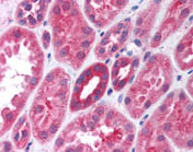 Human Kidney (formalin-fixed, paraffin-embedded) stained with ab118578 at 10 ug/ml followed by biotinylated goat anti-rabbit IgG secondary antibody, alkaline phosphatase-streptavidin and chromogen.
