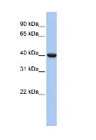Anti-G protein alpha Inhibitor 2 antibody (ab81452) at 1 µg/ml (in 5% skim milk / PBS buffer) + fetal lung lysate at 10 µgSecondaryHRP conjugated anti-Rabbit IgG at 1/50000 dilution