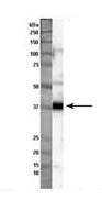 Anti-G protein alpha Inhibitor 2 antibody (ab81452) at 1/1000 dilution + Nthy-ori cell lysate at 50 µgSecondaryHRP anti-rabbit at 1/2000 dilution