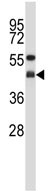 Anti-G protein alpha Inhibitor 2 antibody (ab123427) at 1/100 dilution + SK-BR-3 cell line lysate at 35 µg