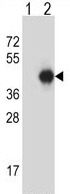 All lanes : Anti-G protein alpha Inhibitor 2 antibody (ab123427) at 1/100 dilutionLane 1 : 293 cell lysate, non-transfected Lane 2 : 293 cell lysate, transiently transfected with Human G protein alpha Inhibitor 2 geneLysates/proteins at 2 µg per lane.