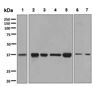 All lanes : Anti-G protein alpha Inhibitor 2 antibody [EPR9468] (ab137050) at 1/1000 dilutionLane 1 : HL60 cell lysateLane 2 : U937 cell lysateLane 3 : MCF7 cell lysateLane 4 : HeLa cell lysateLane 5 : U-87 MG cell lysateLane 6 : C6 cell lysateLane 7 : RAW 264.7 cell lysateLysates/proteins at 10 µg per lane.SecondaryHRP labelled Goat anti-Rabbit IgG at 1/2000 dilution