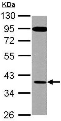 Anti-G-protein coupled receptor 30 antibody (ab137479) at 1/500 dilution + HepG2 membrane lysate at 30 µg