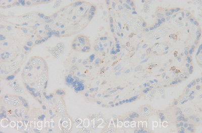 IHC image of GAA staining in human placenta formalin fixed paraffin embedded tissue section, performed on a Leica BondTM system using the standard protocol F. The section was pre-treated using heat mediated antigen retrieval with sodium citrate buffer (pH6, epitope retrieval solution 1) for 20 mins. The section was then incubated with ab102815, 5µg/ml, for 15 mins at room temperature and detected using an HRP conjugated compact polymer system. DAB was used as the chromogen. The section was then counterstained with haematoxylin and mounted with DPX. For other IHC staining systems (automated and non-automated) customers should optimize variable parameters such as antigen retrieval conditions, primary antibody concentration and antibody incubation times.