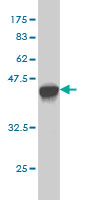 Western blot against tagged recombinant protein immunogen using ab55049 GAA antibody at 1ug/ml.