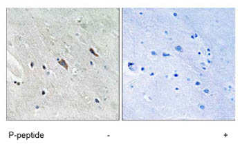 Immunohistochemistry analysis of paraffin-embedded human brain tissue using ab78262 at a 1/50 dilution.Left image un-treated.Right image treated with immunizing peptide.