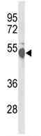 Anti-CREB3L2 antibody (ab102989) at 1/100 dilution + HeLa cell lysate at 35 µg