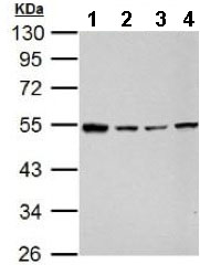 All lanes : Anti-GABA A Receptor alpha 5 antibody (ab153999) at 1/3000 dilutionLane 1 : NT2D1 whole cell lysate Lane 2 : PC-3 whole cell lysate Lane 3 : U87-MG whole cell lysate Lane 4 : SK-N-SH whole cell lysate Lysates/proteins at 30 µg per lane.