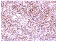 Immunohistochemical analysis of paraffin embedded RF48 xenograft labeling GABA A Receptor alpha 5 with ab153999 antibody at 1/500.