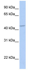 Anti-GABA A Receptor alpha 5 antibody (ab82927) at 1 µg/ml + fetal heart lysate at 10 µgSecondaryHRP conjugated anti-Rabbit IgG at 1/50000 dilution