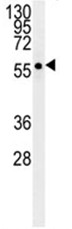 Anti-GABA A Receptor alpha 5 antibody (ab103707) at 1/100 dilution + Mouse kidney tissue lysates at 35 µg