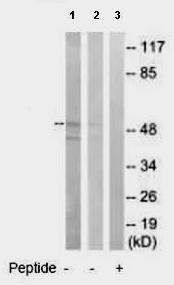 All lanes : Anti-GABA A Receptor alpha 6 antibody (ab92747) at 1/500 dilutionLane 1 : Jurkat cell extractsLane 2 : HeLa cell extractsLane 3 : HeLa cell extracts with immunizing peptide at 10 µgLysates/proteins at 20 µg per lane.