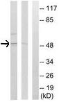 All lanes : Anti-GABA A Receptor delta antibody (ab110014) at 1/500 dilutionLane 1 : extracts from HT29 cells (5-30 ug total protein) with no immunizing peptideLane 2 : extracts from LOVO cells (5-30 ug total protein) with no immunizing peptideLane 3 : extracts from LOVO cells (5-30 ug total protein) with immunizing peptide (5-10 ug)