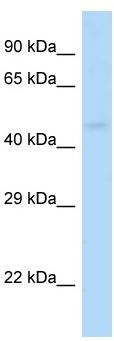 Anti-GABA A receptor pi antibody (ab116109) at 1 µg/ml + Mouse Kidney Lysate at 10 µg