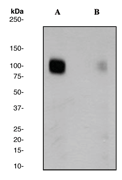 All lanes : Anti-GABA B Receptor 2 (phospho S893) antibody [EP2318Y] (ab68426) at 1/1000 dilutionLane 1 : Human brain lysate - untreatedLane 2 : Human brain lysate - treated with APLysates/proteins at 10 µg per lane.SecondaryHRP labelled Goat anti-Rabbit antibody at 1/2000 dilutionObserved band size : 106 kDa (why is the actual band size different from the predicted?)