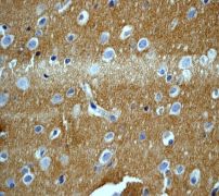 Immunohistochemical analysis of phosphorylated GABA B Receptor 2 expression on paraffin-embedded Human brain tissue using 1/100 ab68426. Heat mediated antigen retrieval was performed, and an HRP-conjugated polymerized secondary antibody was used.
