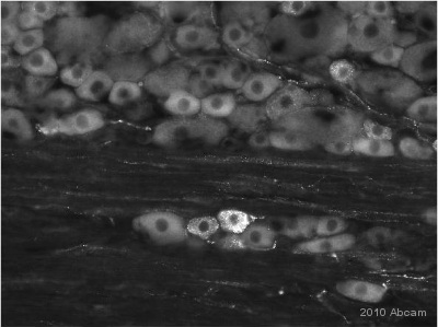 Immunohistochemistical detection of GABA B Receptor 2 antibody (ab52248) in PFA fixed Rat Dorsal root ganglion sections. ab52248 was used at 1/300 and incubated for 60 hours @ 4°C in PBS-T 0.3%. Secondary antibody: anti IgG Rabbit Conjugation: Alexa Fluor® 488 (1/1000).