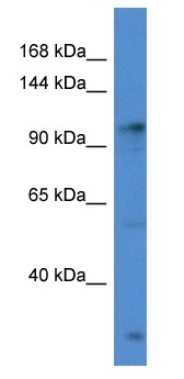 Anti-GABA B Receptor 2 antibody (ab115929) at 1 µg/ml + HeLa cell lysate at 10 µg