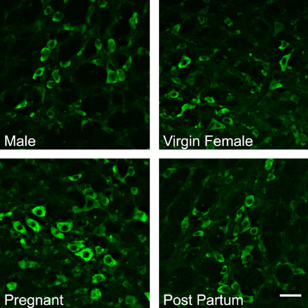 Immunohistochemical analysis of male, virgin female, G17 pregnant, and 30 d post-partum rat medullary neurons, staining GABA Receptor Epsilon with ab35971 at 1/1000 dilution.
