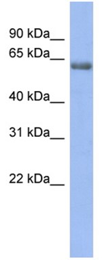 Anti-GABA Receptor Epsilon antibody (ab94718) at 1 µg/ml (in 5% skim milk / PBS buffer) + Human fetal stomach lysate at 10 µgSecondaryHRP conjugated anti-Rabbit IgG at 1/50000 dilution