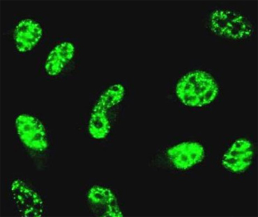 ab55052 at 10 ug/ml staining GABPA in human Hela cells by Immunocytochemistry/ Immunofluorescence.