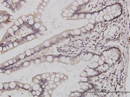 GABPA antibody (ab55053) used in immunohistochemistry at 3ug/ml on formalin fixed and paraffin embedded human small Intestine.