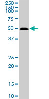 Anti-GABPB2 antibody (ab88746) at 1 µg/ml + HeLa nuclear extracts at 50 µg