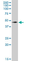 Anti-GABPB2 antibody (ab88746) at 1 µg/ml + Jurkat cell lysate at 50 µg