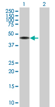 All lanes : Anti-GABPB2 antibody (ab88746) at 1 µg/mlLane 1 : lysate from transfected 293T cellsLane 2 : lysate from non-transfected 293T cellsLysates/proteins at 25 µg per lane.